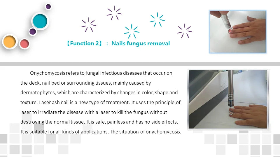 Diode Blood Vessels Removal Nail Fungus BEST 60W 980nm  Vascular Removal Machine Remove Spider Veins