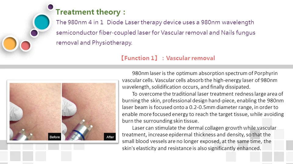980Nm Laser Diode Vascular Spider Varicose Vein Removal Machine Treatment Fungi Physiotherapy