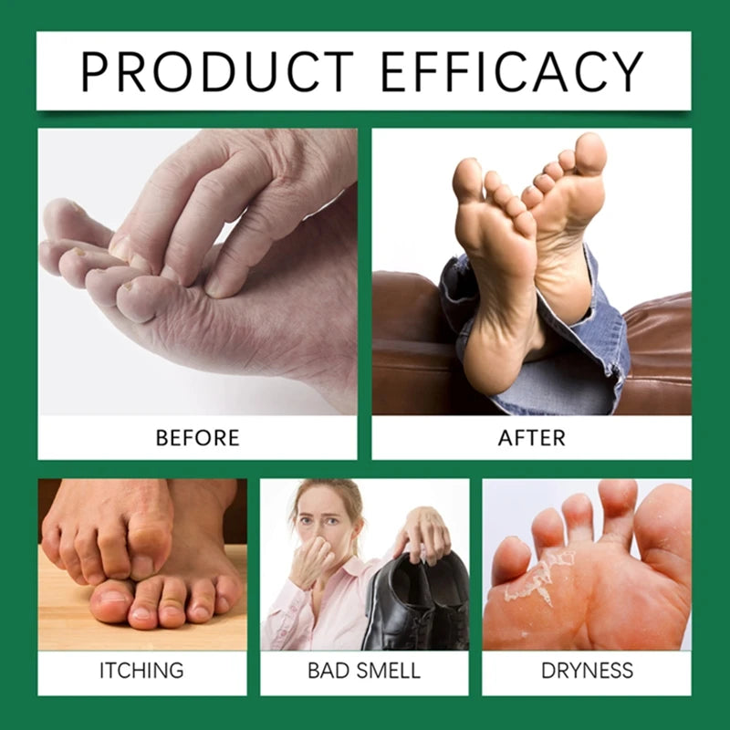 100ml Foot Care Spray Remove Dead Foot Exfoliator Softener Gently Cares Foot Skin Moisturizes Hydrates Improves Dryness