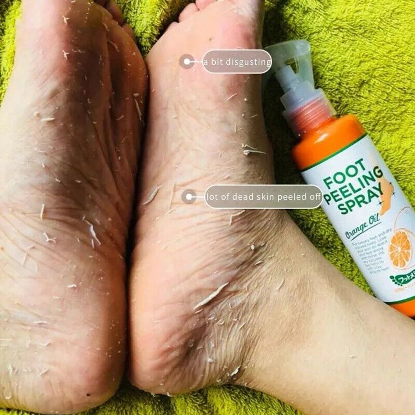100ml Foot Care Spray Remove Dead Foot Exfoliator Softener Gently Cares Foot Skin Moisturizes Hydrates Improves Dryness