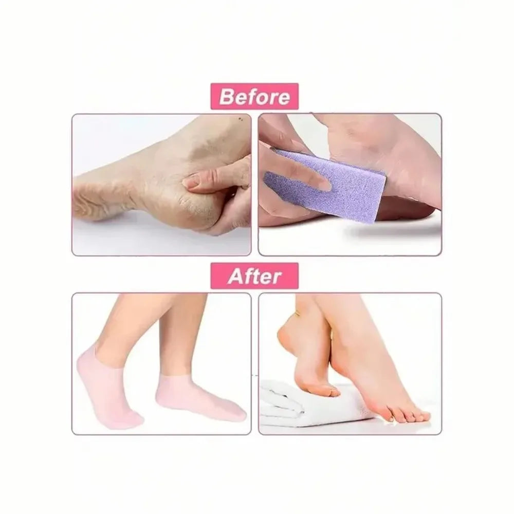 Moisturizing Foot Socks,Silicone Socks for Dry Cracked Feet Women's Foot Socks for Moisturizing,Featuring