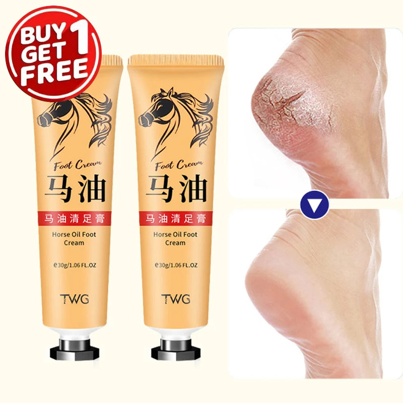 Ma You Qing Foot Cream, Moisturizing Foot Cream, Suitable for Dry Skin, Suitable for Hand and Foot Care for Dry Hands and Feet