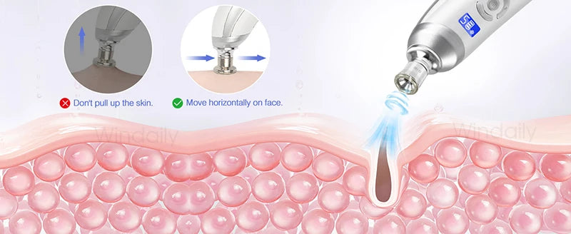 2025 Wireless Diamond Microdermabrasion Machine Blackhead Remover Vacuum Pore Cleaner Facial Skin Care Tool Face Beauty Device