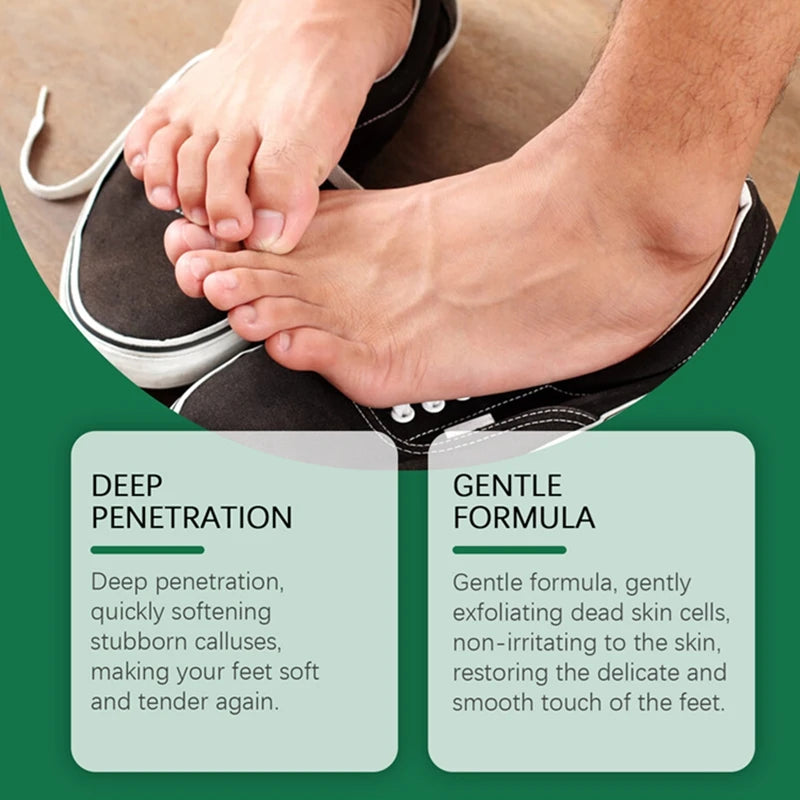 100ml Foot Care Spray Remove Dead Foot Exfoliator Softener Gently Cares Foot Skin Moisturizes Hydrates Improves Dryness